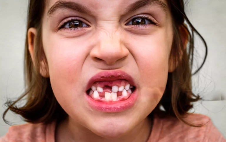 Do Baby Teeth Have Nerves? Uncover the Surprising Truth!