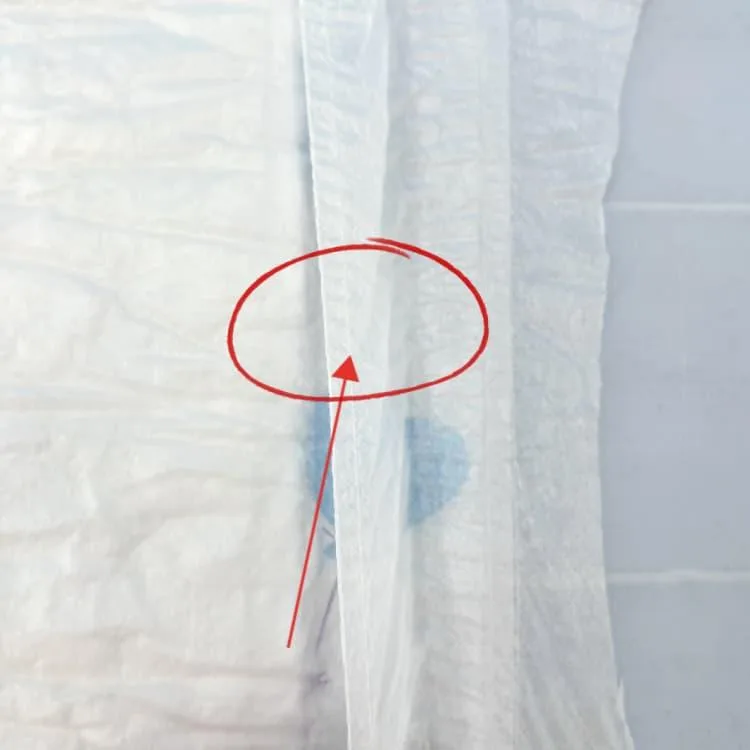 leg-cuff leakage